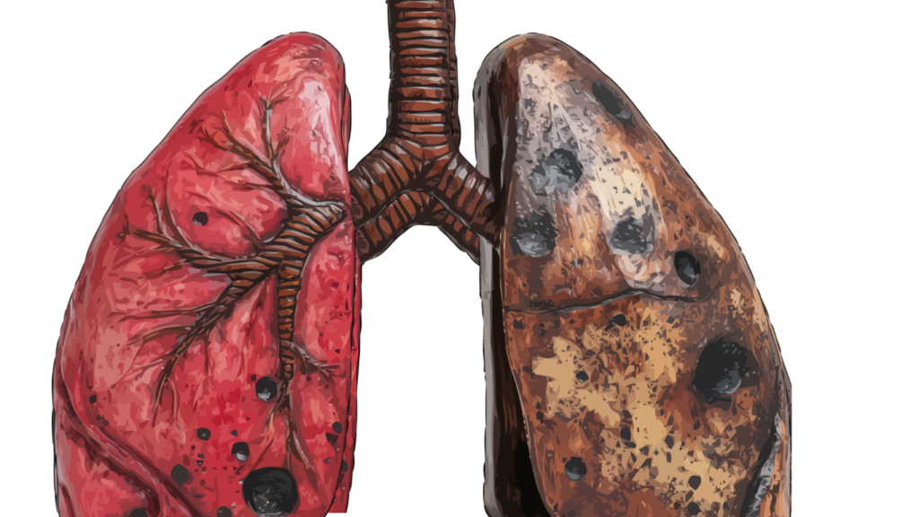  Kako Prirodno Očistiti Pluća